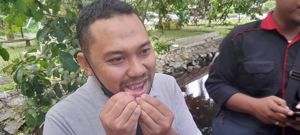 JEMPUT LANGGANAN OFFLINE, DRIVER OJOL INI ALAMI LUKA BIBIR PECAH SETELAH DIHADANG DAN DITONJOK OLEH OKNUM DRIVER TAKSI BANDARA 1 JEMPUT LANGGANAN OFFLINE, DRIVER OJOL INI ALAMI LUKA BIBIR PECAH SETELAH DIHADANG DAN DITONJOK OLEH OKNUM DRIVER TAKSI BANDARA 2